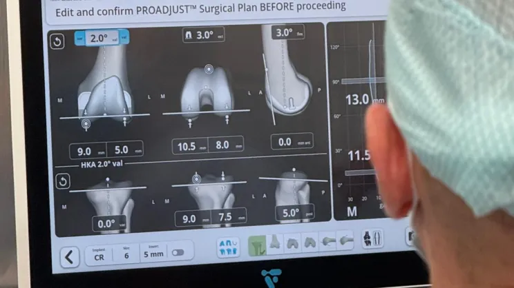 Operacja z pomocą robota ortopedycznego